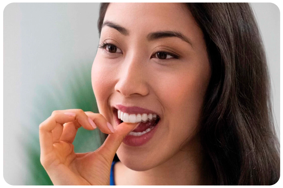 The Modern Solution for a Perfect Smile: Clear Aligners